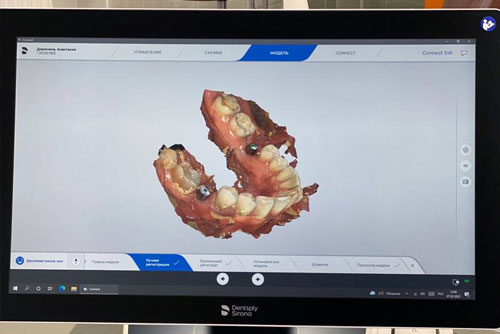Цифровая стоматология в медицинском центре - фотография